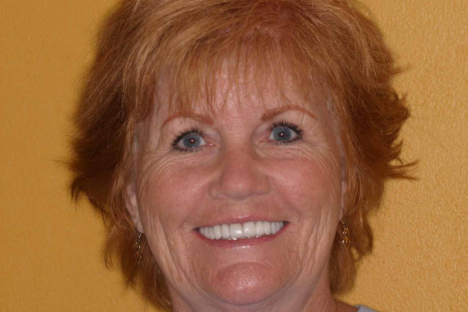 Cosmetic Dentist Fort Myers Cape Coral Naples FL